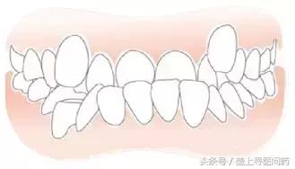 关于牙医你最想知道的是什么,关于正畸你想知道的都在这里