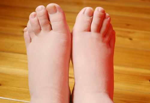 孕吐太难受？这些才是孕期最难熬的事情！