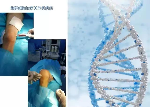 巨噬细胞衰老骨质疏松,成骨细胞会衰老吗