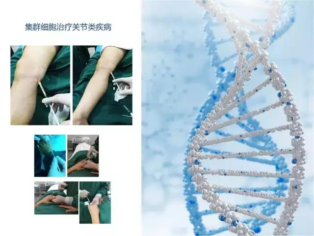 巨噬细胞衰老骨质疏松,成骨细胞会衰老吗