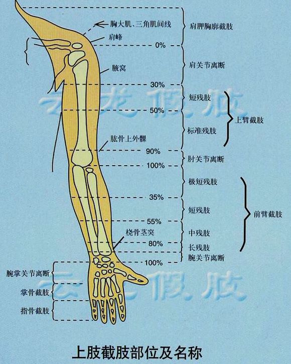 假肢装配后功能训练有哪些,假肢组装过程视频