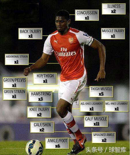 足坛玻璃人,足坛玻璃人阵容