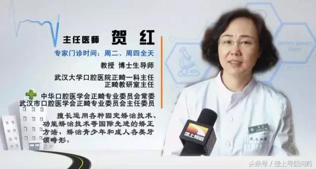 关于牙医你最想知道的是什么,关于正畸你想知道的都在这里