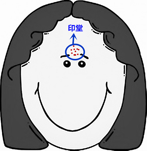 超全面面部痘痘分析图文，了解身体状况！