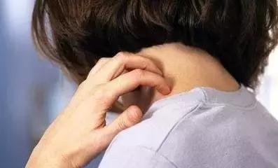 水槽里出现这种像蚂蟥的软体虫，真的得关注了！