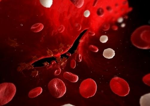 轻度血友病患者的表现,血友病最早发病案例