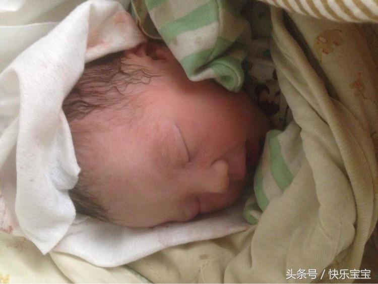 孕妇顺产撕裂恢复,顺产孕妈痛到尖叫