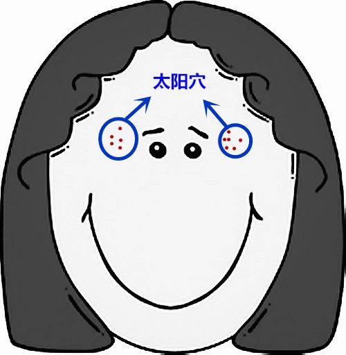 超全面面部痘痘分析图文，了解身体状况！