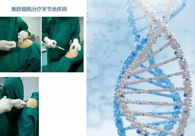 巨噬细胞衰老骨质疏松,成骨细胞会衰老吗