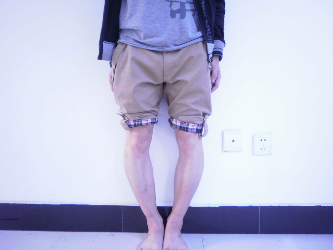 翘二郎腿导致腿部变形怎么矫正,翘二郎腿变形了有没有办法矫正