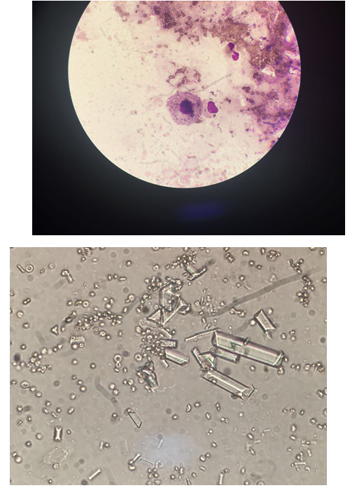 猫膀胱炎尿血但是精神正常,猫膀胱炎尿不出来怎么办