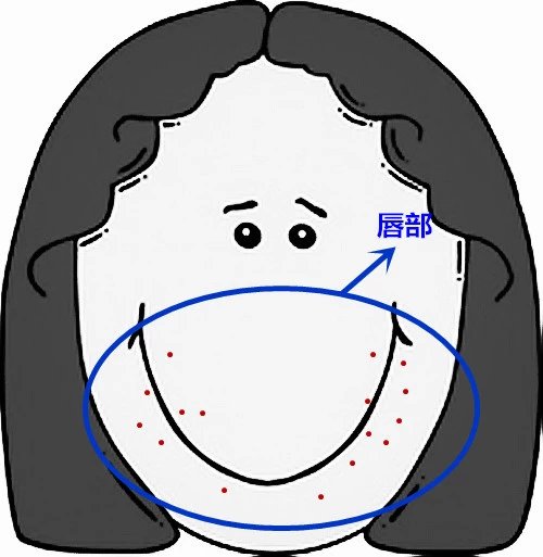 超全面面部痘痘分析图文，了解身体状况！