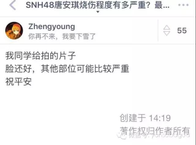 唐安琪snh48怎样被烧伤的,snh48的令人心疼的瞬间