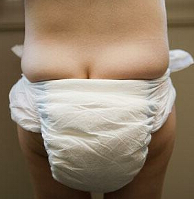 22岁尿尿分叉是啥原因,从小到大尿分叉