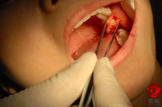 大姨妈期间最应该做哪些事,大姨妈期间女性做这3件事