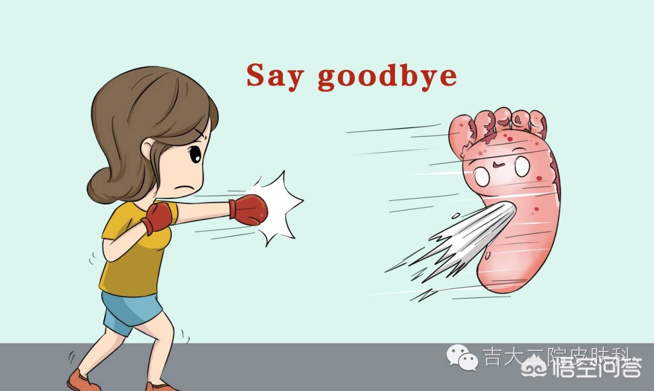 治疗脚气的四种中药材,医院有没有治疗脚气的外用药