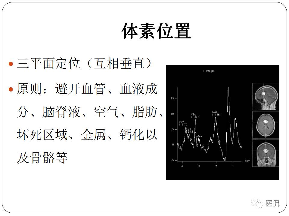 神经系统解剖ppt课件,神经内科课件ppt