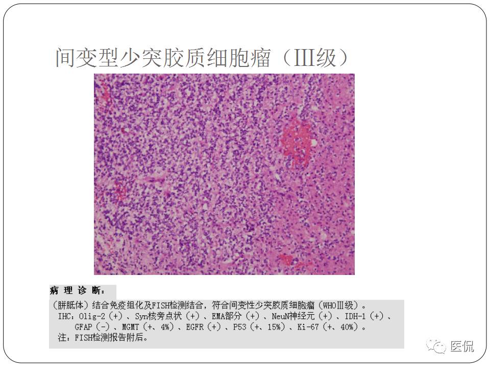 神经系统解剖ppt课件,神经内科课件ppt