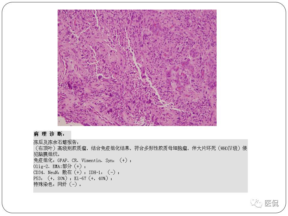 神经系统解剖ppt课件,神经内科课件ppt