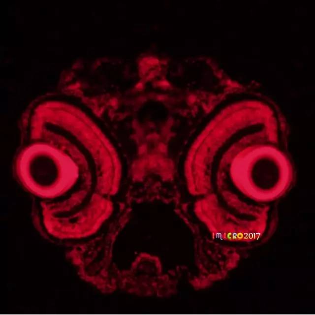 微观星球显微镜下的奇妙世界,显微镜下的奇妙世界视频