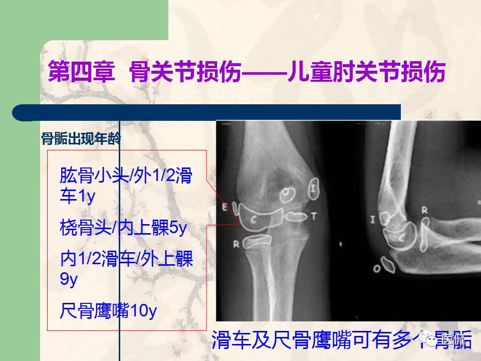 骨关节创伤x线诊断图谱,骨关节损伤x线图