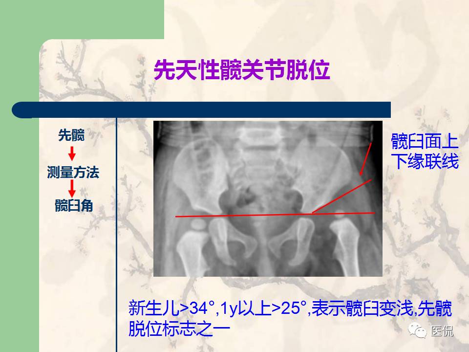 骨关节创伤x线诊断图谱,骨关节损伤x线图