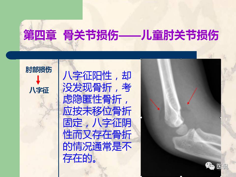 骨关节创伤x线诊断图谱,骨关节损伤x线图