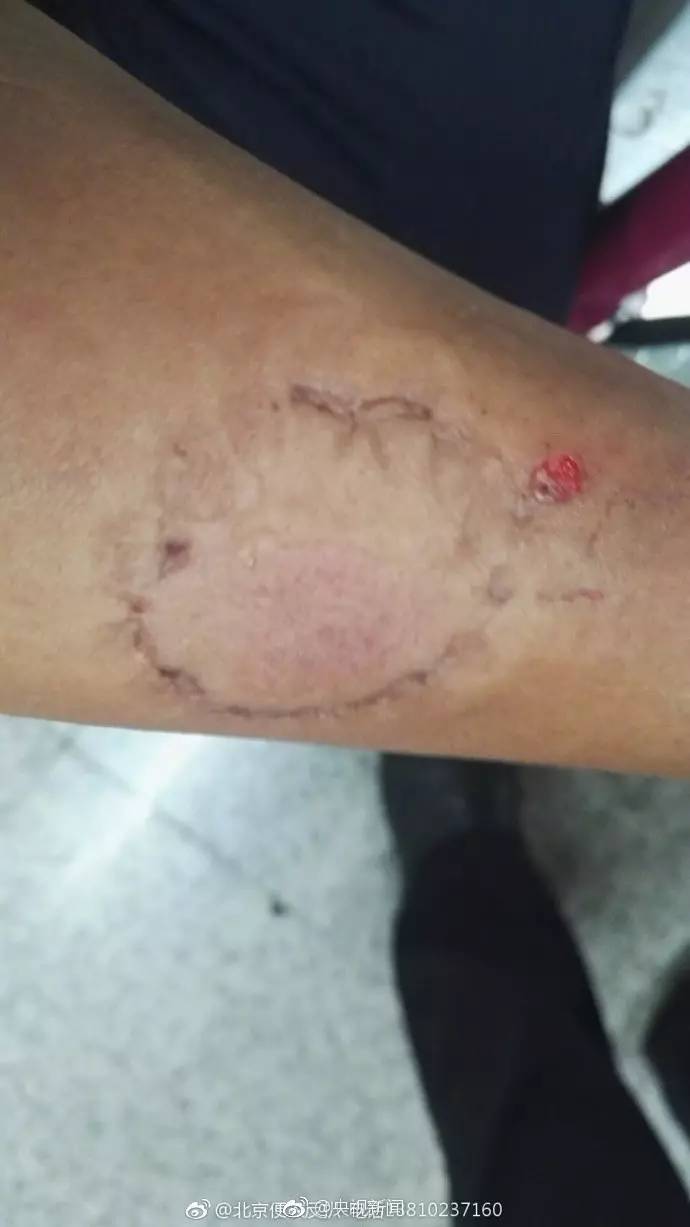 高温持续20天后连续下大雨,高温持续20天突降暴雨