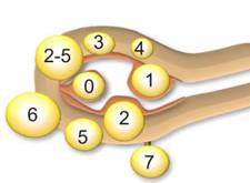人流和子宫肌瘤手术可以一起做吗,宫外孕和子宫肌瘤可以一起手术吗