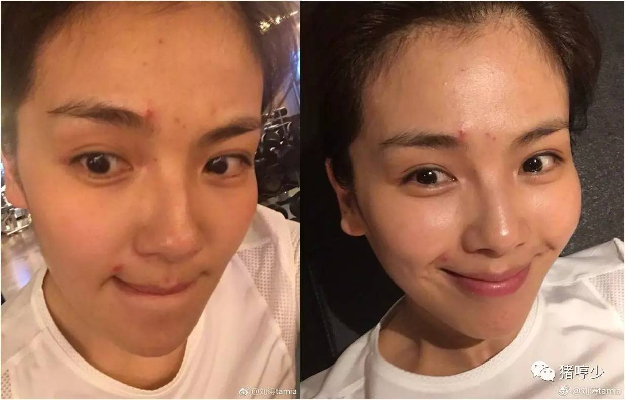 明星皮肤真的不长痘吗,脸上不长痘