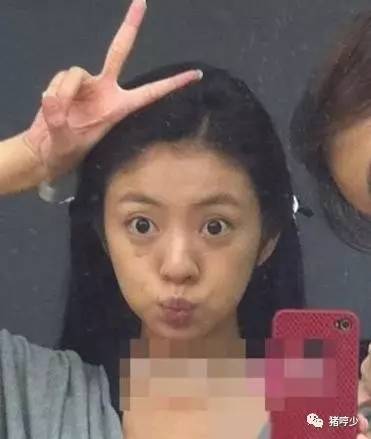 明星皮肤真的不长痘吗,脸上不长痘