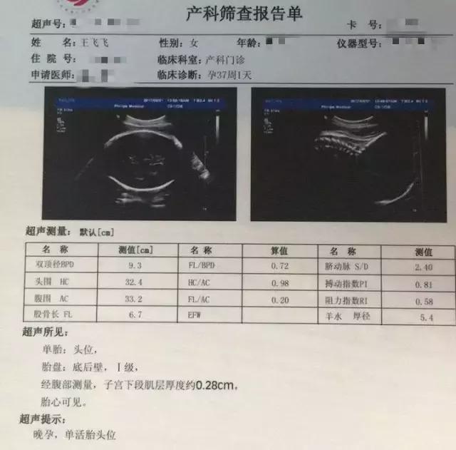 胎盘三级还有多久分娩,胎盘三级是不是表示宝宝快出生了