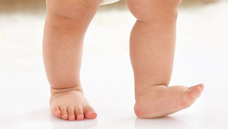 小孩子走路姿势不对挂什么科,宝宝走路姿势不对怎么纠正