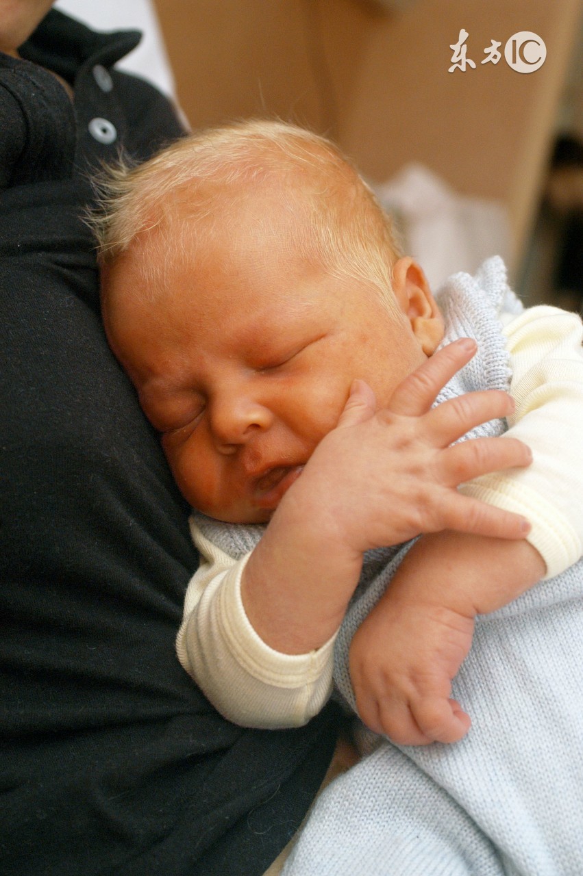 新生儿黄疸吃药后拉什么样的便便,新生儿黄疸吃药还是抹药