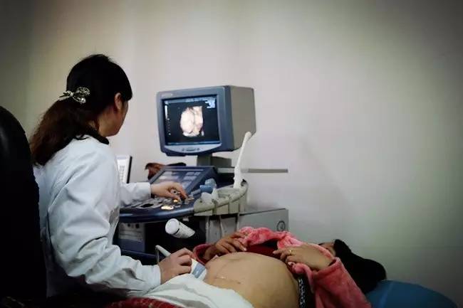 胎儿发育异常四维彩超能看出吗,四维彩超孕妈检查出畸形