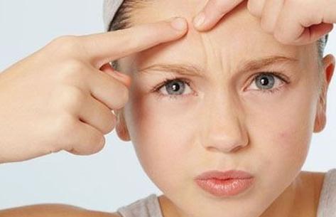 眉心长痘是什么原因怎么消除呢,嘴上长痘最快消除方法
