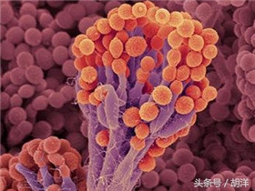 头孢类抗生素不能和什么药一起使用，用错了可能会出生命危险