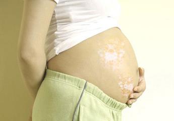 白癜风季节,为什么秋季不能治疗白癜风