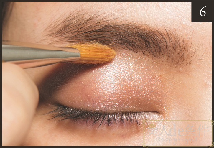 眉头太低打玻尿酸怎么能提上去,经常皱眉要不要打玻尿酸