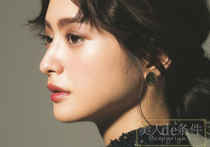 眉头太低打玻尿酸怎么能提上去,经常皱眉要不要打玻尿酸