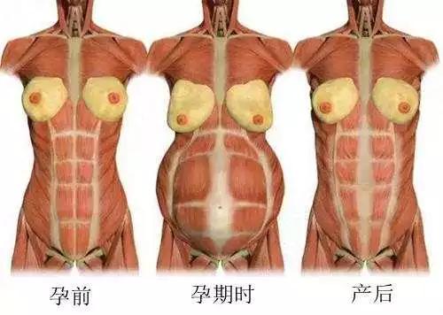 生娃后十天后肚子依然很大怎么办,生完孩子肚子一直下不去怎么办