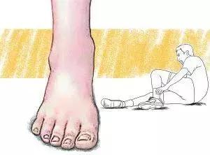 别把崴脚当小事,崴脚别不当回事