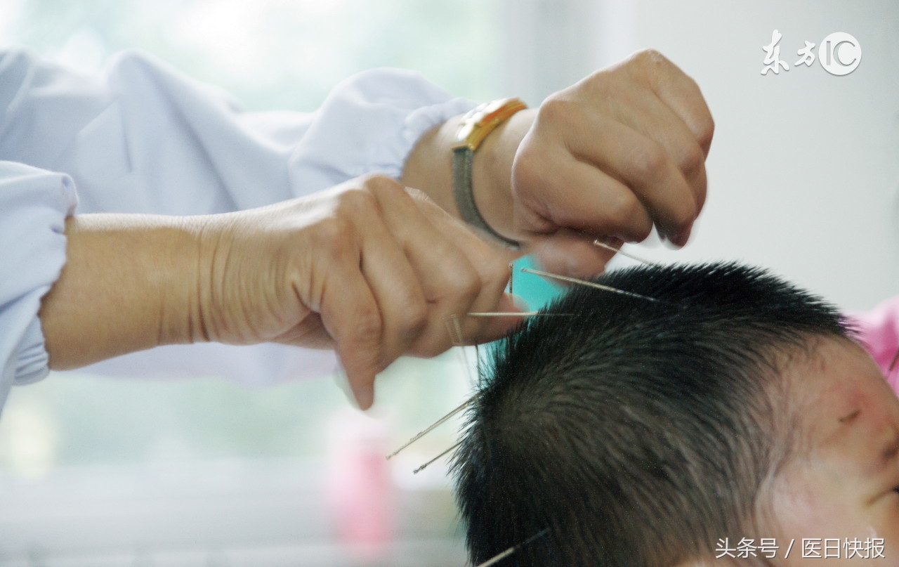 治疗脑瘫的最佳方子,脑瘫秘方