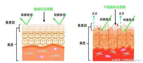 皮肤的皮脂膜受损怎么修复,皮脂膜受损皮肤干