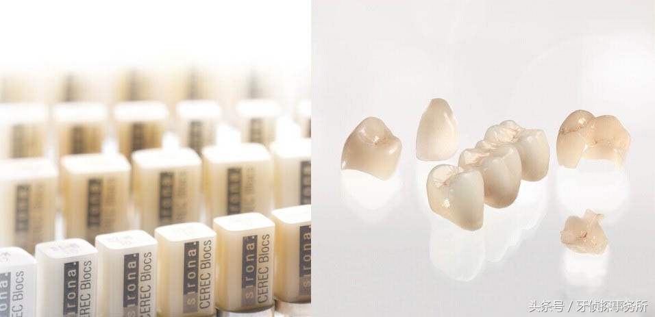 纳米补牙和树脂补牙区别,自己用补牙材料补牙