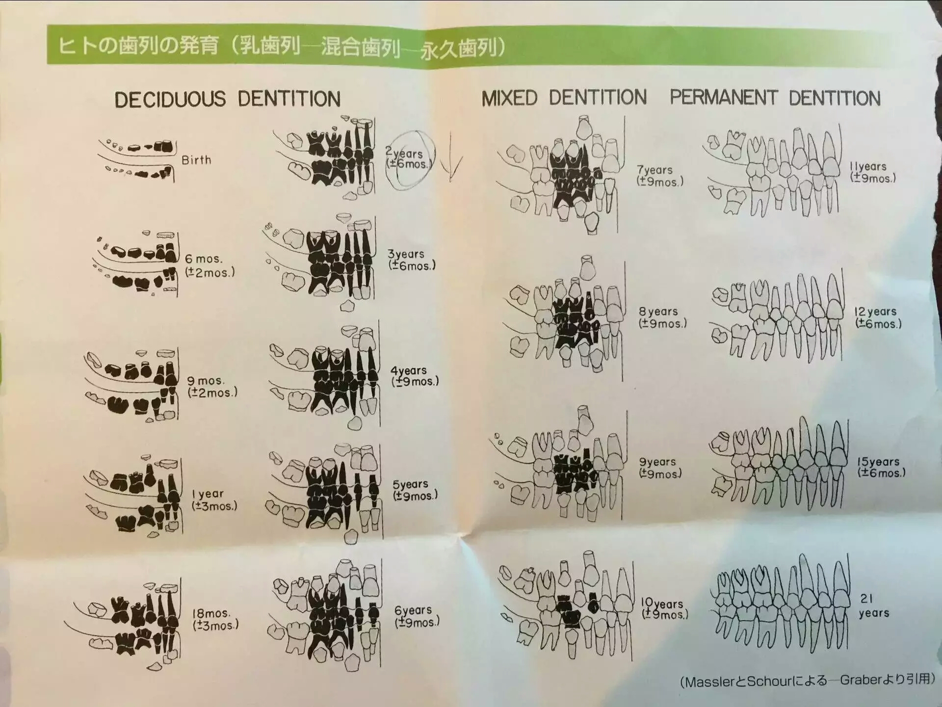 宝宝护牙的四大攻略,牙医爸爸给孩子修牙