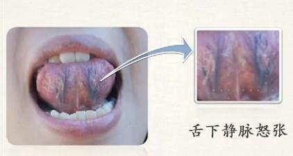 李铁红医生靠谱吗,舌头诊断疾病最简单的方法