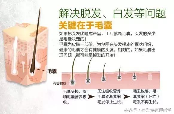 头发少适合什么发型,头发少怎么扎好看