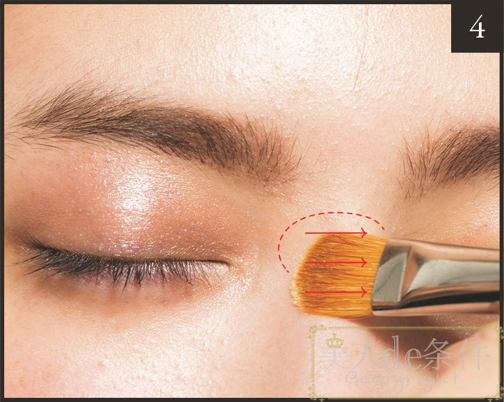 眉头太低打玻尿酸怎么能提上去,经常皱眉要不要打玻尿酸