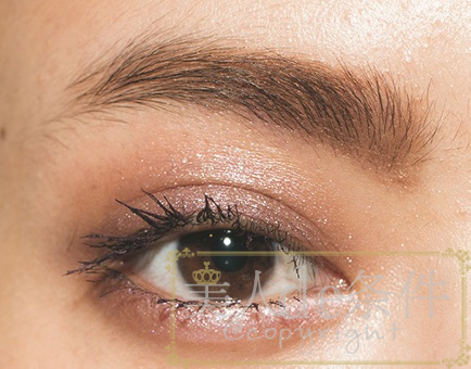 眉头太低打玻尿酸怎么能提上去,经常皱眉要不要打玻尿酸